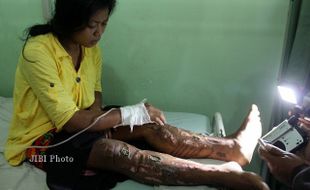 PENYAKIT ANEH: 3 Paku Muncul Lagi di Kaki Supiyati