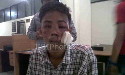 AKSI KEKERASAN DI MAKASAR:  YLBHI Desak Kapolri Tindak Tegas Polisi Penganiaya Mahasiswa