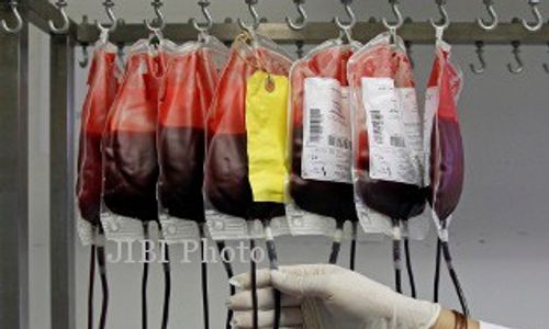 PMI Kota Jogja Temukan 3 Pendonor Darah Terindikasi HIV