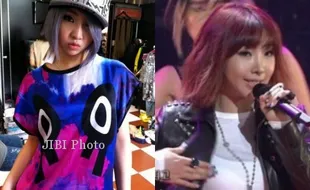 K-POP : Netizens : Minzy 2ne1 Lakukan Operasi Plastik!