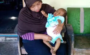 Naufal, Bayi 8 Bulan Butuh Cangkok Hati