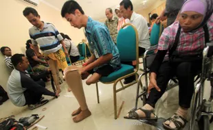 FOTO KEGIATAN CSR : Memasang Kaki Palsu 