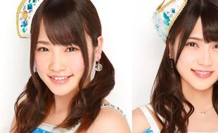 Wah, 2 Personel AKB 48 Luka Serius Digergaji Fans