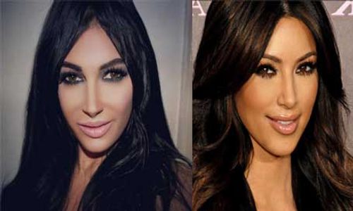 KISAH UNIK : Demi Mirip Kim Kardashian, Wanita Ini Habiskan Rp350 Juta Demi Operasi Plastik