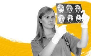 TIPS KESEHATAN : Ini Penyebab Utama Stroke di Usia Muda