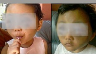 KISAH TRAGIS : Bocah Korban Penganiayaan Ibu di Wonogiri Tewas