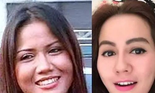 SENSASI ARTIS : Nita Talia Akhirnya Beberkan Alasan Operasi Plastik