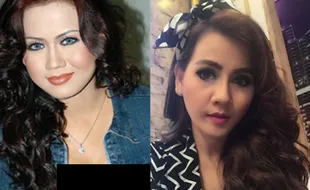 SENSASI ARTIS : Heboh! Nita Talia Operasi Plastik