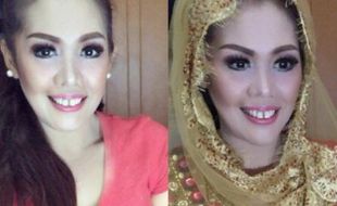 INSTAGRAM ARTIS : Isu Operasi Plastik, Ini "Before and After" Elly Sugigi