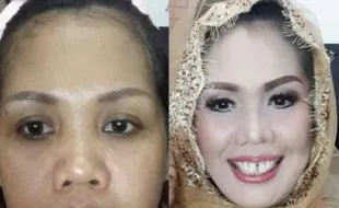 INSTAGRAM ARTIS : Lebih Tirus, Elly Sugigi Operasi Plastik? 