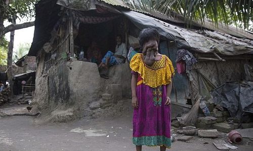 21 Tahun Hidup Tanpa Wajah, Begini Sikap Ikhlas Khadija 