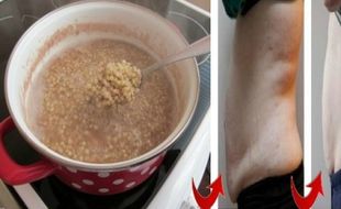 TIPS DIET SEHAT : Turunkan 14 Kg Dalam 2 Pekan dengan Kacang Lentil