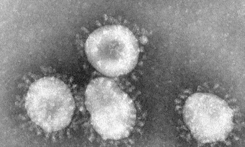 HASIL PENELITIAN : Ini Bentuk Koronavirus, Penyebab Penyakit SARS dan MERS