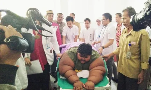 Bocah Berbobot 190 Kg Ditarget Susutkan Berat Badan 150 Kg, Ini Rencana RSHS