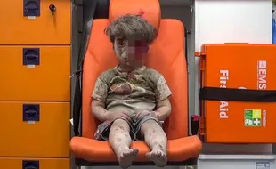 FOTO OMRAN DAQNEESH : Pemandangan Memilukan Bocah Suriah Korban Perang Saudara