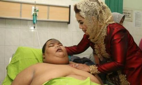 Remaja Obesitas Berbobot 190 Kg Meninggal Dunia