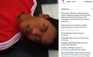 Begini Pendapat Dokter Soal Bahaya Skip Challenge