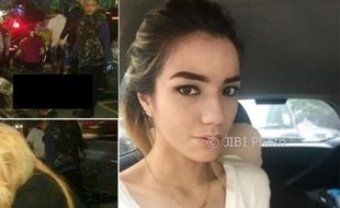 Kecelakaan di Tol, Hidung dan Pelipis Sheila Marcia Retak