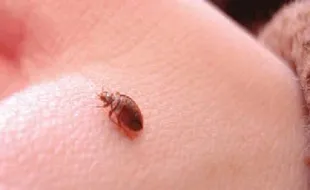 Ini Gejala Penyakit Lyme yang Ditularkan dari Kutu