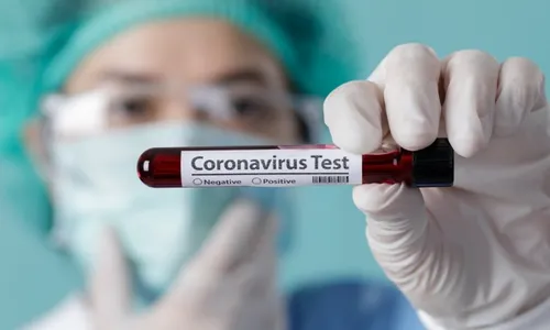 Rapid Test Pemudik Nguter Sukoharjo Positif Corona, Sekda: Baru Screening Awal, Warga Tak Perlu Panik