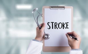 Mengenal Beragam Gejala Stroke, Penanganan Kurang dari 4,5 Jam Jadi Kunci