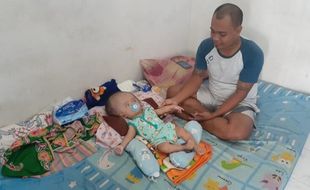 Kisah Bayi 6 Bulan Penderita Hidrosefalus di Madiun, Butuh Uluran Tangan