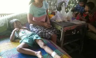 Kasar dan Tajam, Begini Bentuk Benang Gelasan yang Gores Kaki Bocah 5 Tahun di Sragen