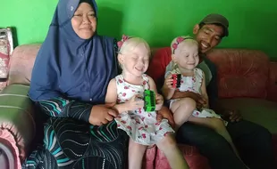 Anak Kembar Albino di Wonogiri Mirip Bule, Orang Tuanya Sempat Dikira Pembantu