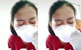 Bikin Terenyuh, Perawat Ini Lepas Masker Sambil Kesakitan