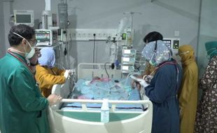 Libatkan 20 Dokter, RSUD dr Moewardi Solo Sukses Pisahkan Bayi Kembar Siam