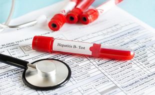 Hepatitis B Bisa Dicegah, Ini Penjelasan Dokter