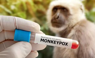 WHO Ubah Nama Monkeypox Jadi Mpox