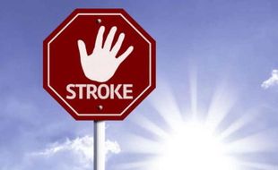 Soal Potensi Stroke Bisa Sembuh Total, Begini Penjelasan Dokter Ahli