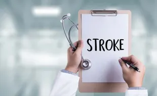 Tindakan DSA Bisa Dilakukan untuk Atasi Stroke pada Penderita Hipertensi