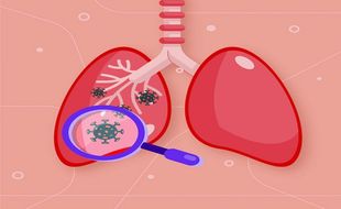 Sulitnya Memutus Mata Rantai Tuberkulosis