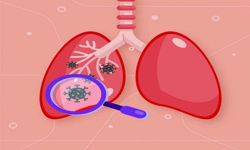 Waspada! Kasus Tuberkulosis Solo Terus Meningkat, Tahun Ini Sudah 1.259 Kasus