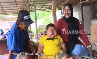 Bayi Obesitas Kenzi di Bekasi Jadi Sorotan Warganet, Ini Kata Pakar