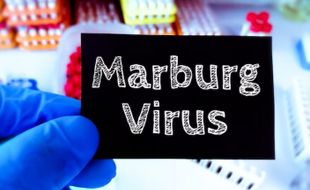 Kenali Virus Marburg yang Dapat Bertahan pada Tubuh Penyintas