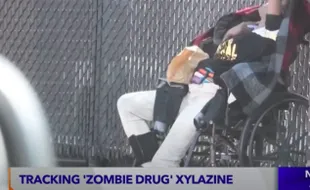 Viral Narkoba yang Ubah Pengguna Jadi ‘Zombie’ di AS, Kulit & Daging Membusuk