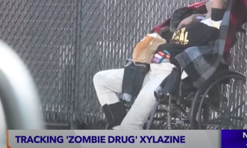 Viral Narkoba yang Ubah Pengguna Jadi ‘Zombie’ di AS, Kulit & Daging Membusuk