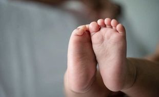 Kenali Sejak Dini Kaki Pengkor pada Bayi dan Cara Penanganannya