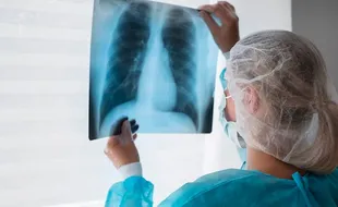 Kasus Mycoplasma Pneumoniae Ditemukan di Indonesia, DKK Solo Sudah Antisipasi