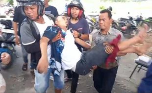 Duh! Lebaran Asyik Wisata di Pantai Pemalang, 3 Wisatawan Tersengat Ikan Pari