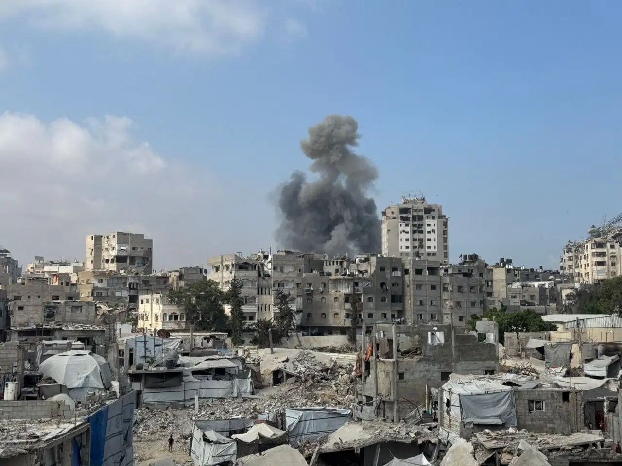 Semakin Banyak Warga Gaza Jadi Buta akibat Serangan Israel