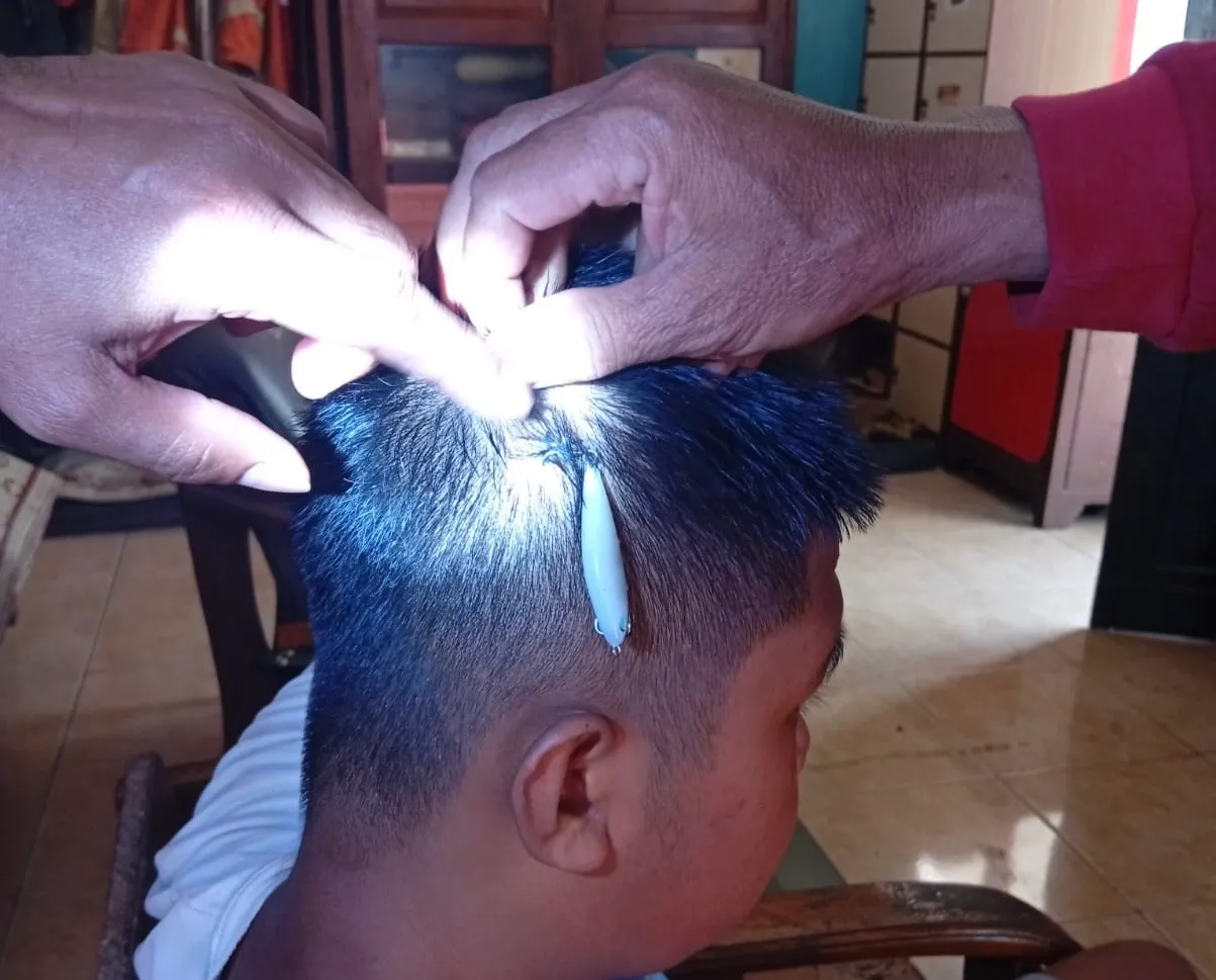 Kail Pancing Menancap di Kepala, Remaja Wonogiri Minta Bantuan Damkar